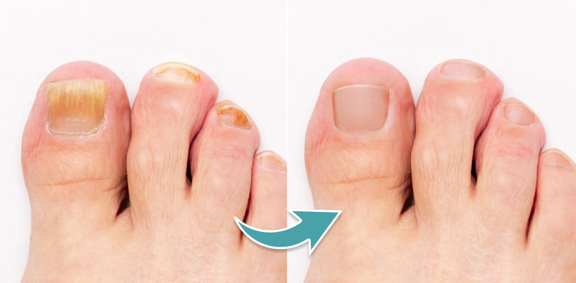 INFORMACJE DERMATOLOGICZNE